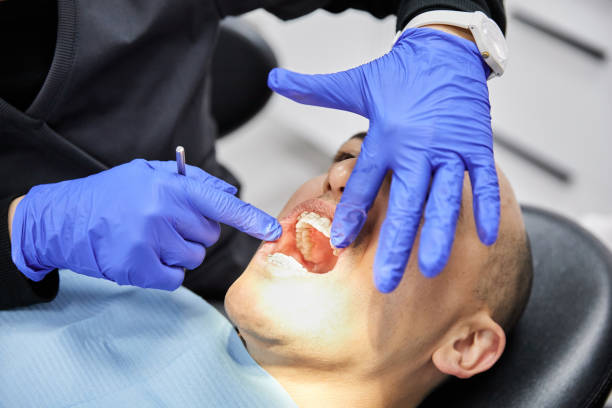 Best Emergency Broken Tooth Repair in East Syracuse, NY